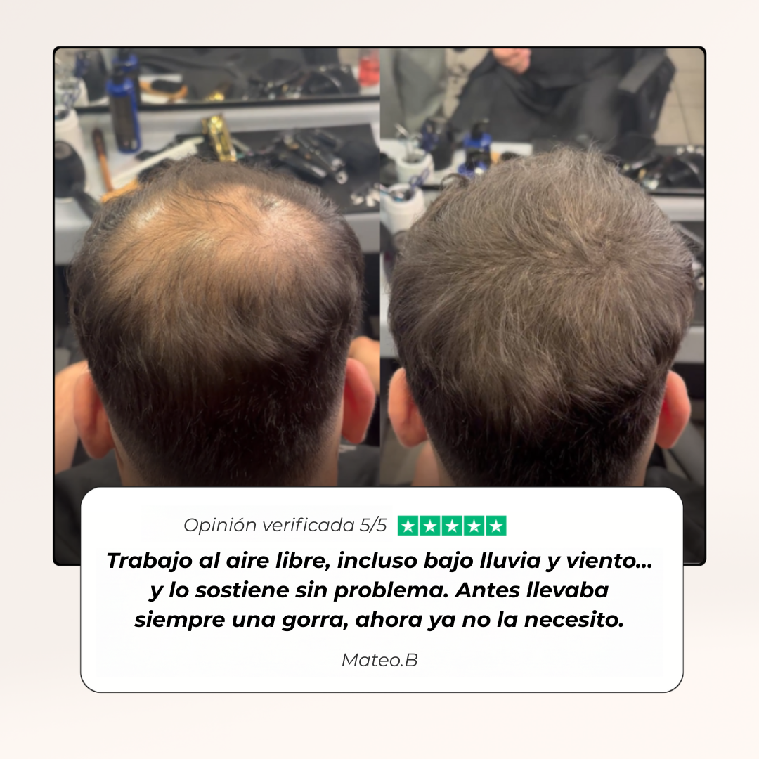 Densificador Capilar